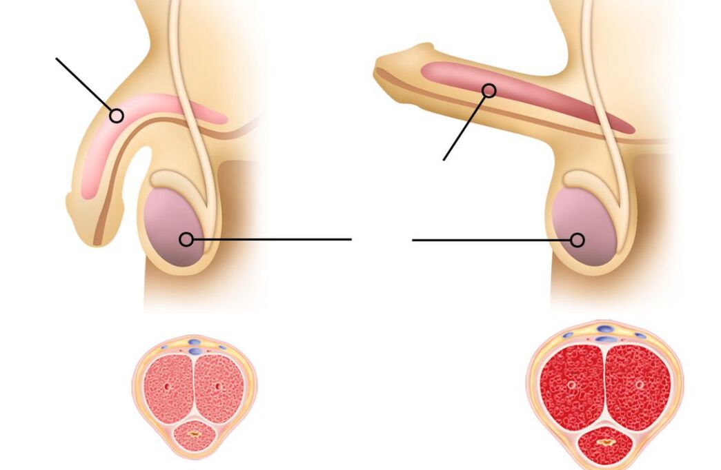 Reasons for Male Potency Decline